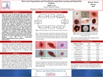 Skin Lesion Segmentation and Classification using Deep Learning and Handcrafted Features