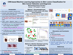 CNN-based Machine Learning Approaches to Skin Lesion Classification for Skin Cancer Detection and Diagnosis.